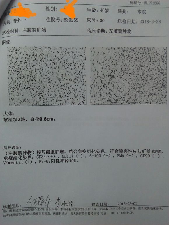 关于隆突性皮肤纤维肉瘤。