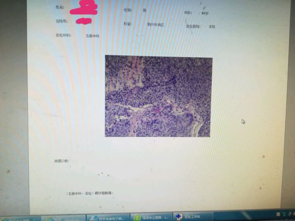 求大家给个意见