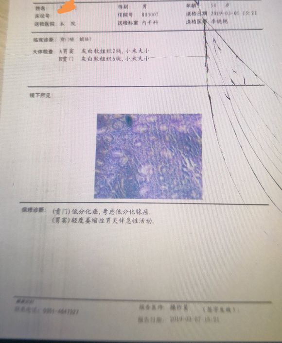 胃癌晚期，不能手术，现在正在化疗。