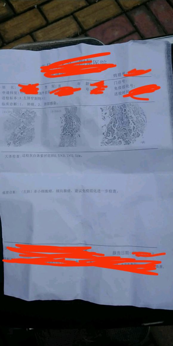 大家好这样的情况是不是只能靶向药和化疗