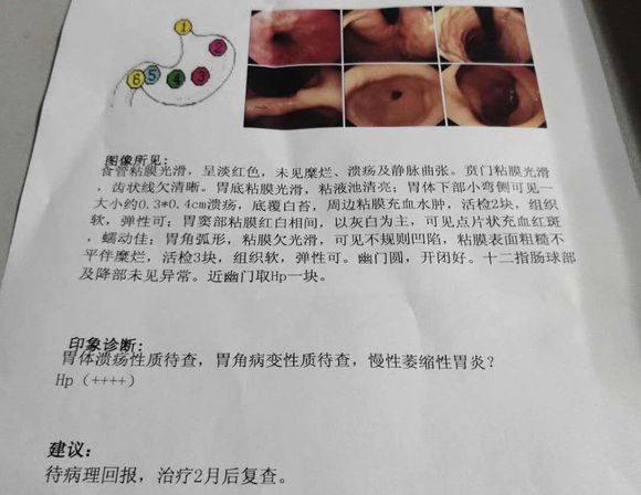 我妈，大神们看看，担心啊马上高考了