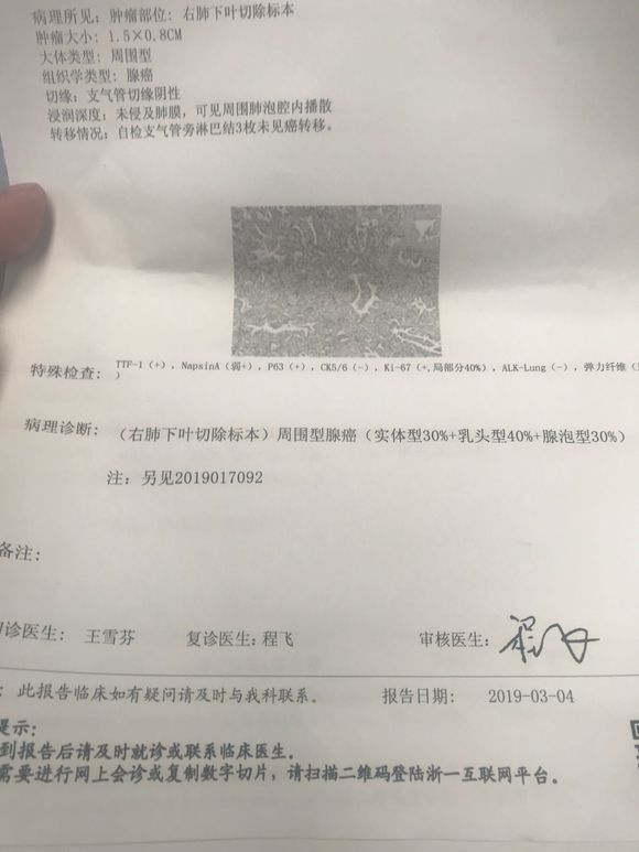 我妈前段时间做了肺癌根治手术