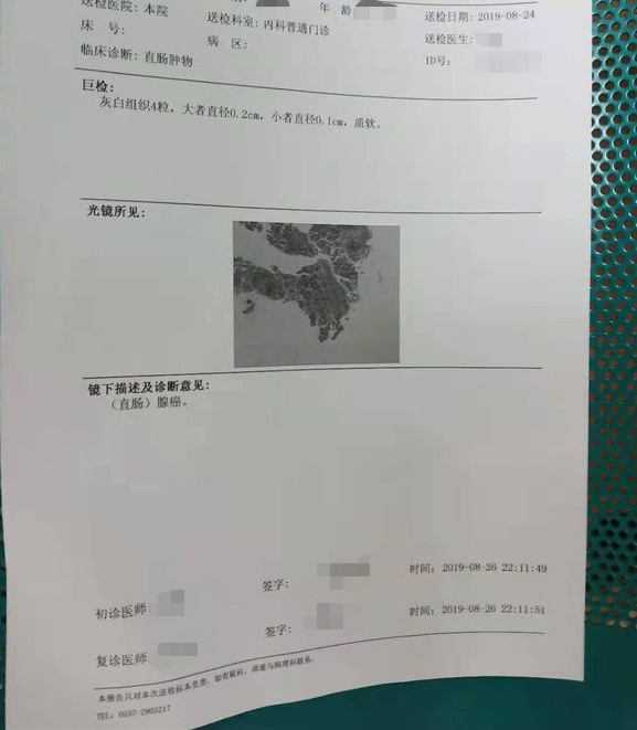 直肠腺癌能帮忙看看这个病理是不是不全呀。怎么看分化