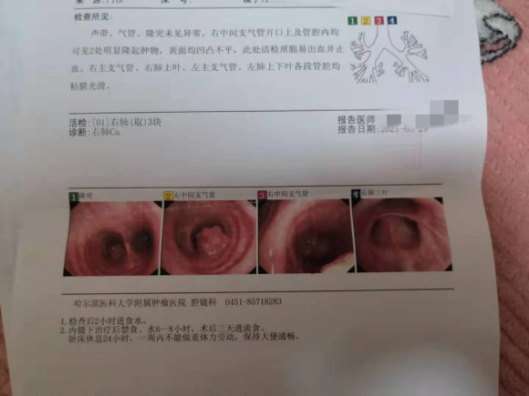 刚检查出出来肺癌，方寸大乱，不知道该怎么办？