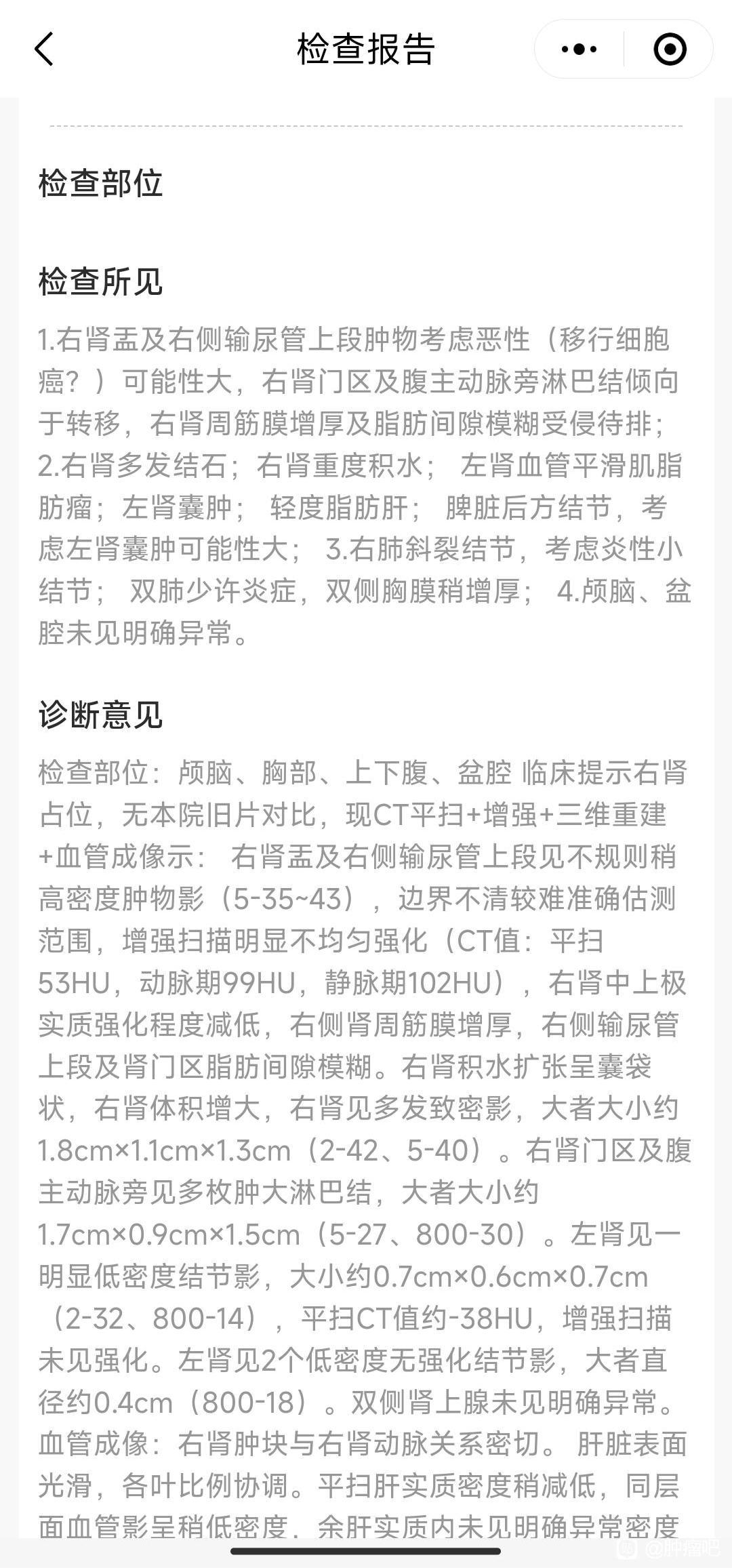 肾癌是不是很严重了？