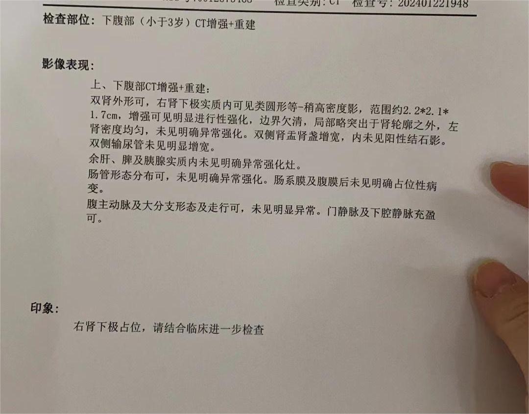 求救！术中检测小圆细胞恶性肿瘤