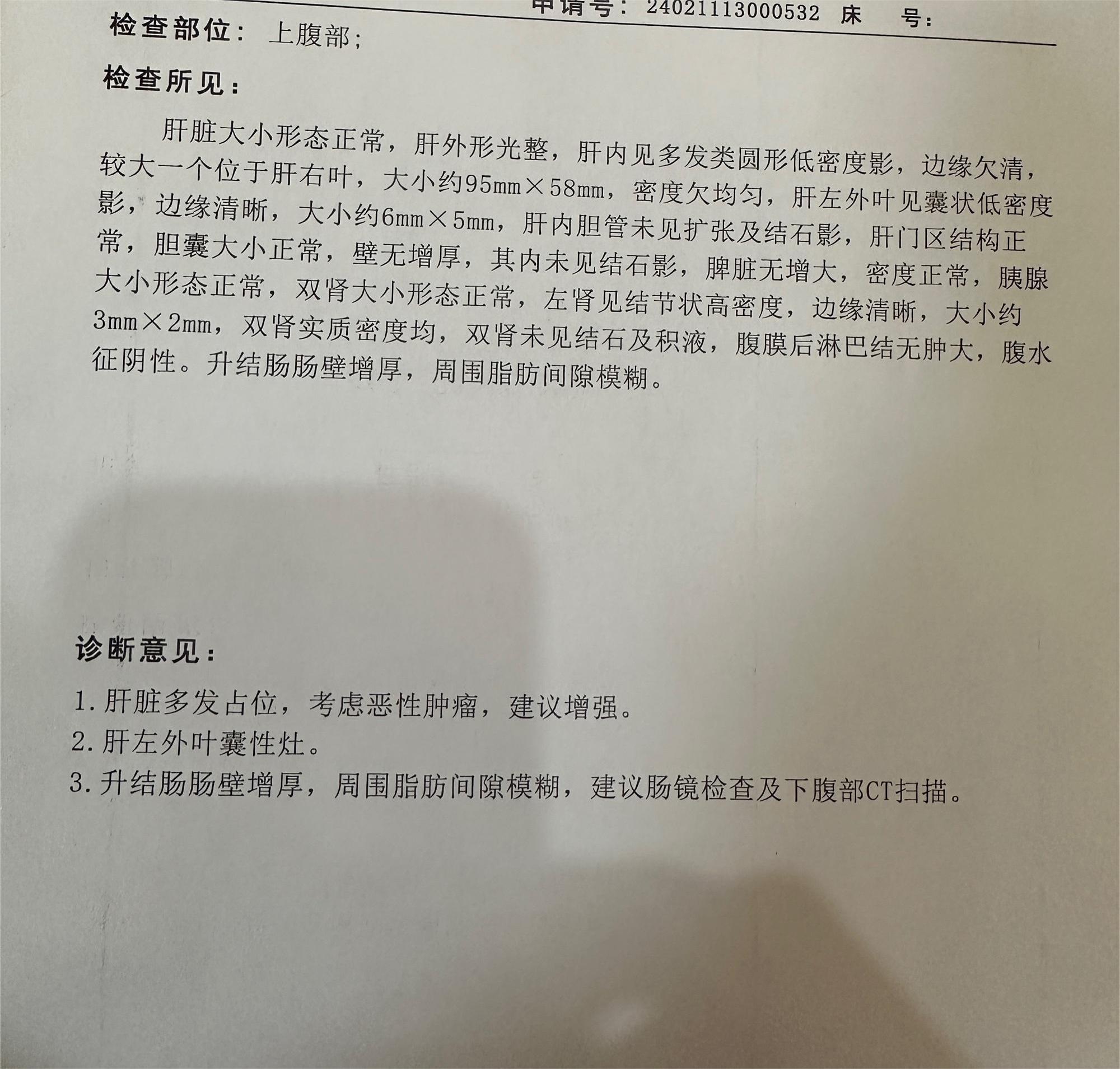 肝癌怎么治疗，求救。